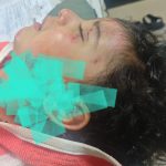 शिमला में कुत्तों ने उठा ले गया 2 साल का मासूम, हालात गंभीर